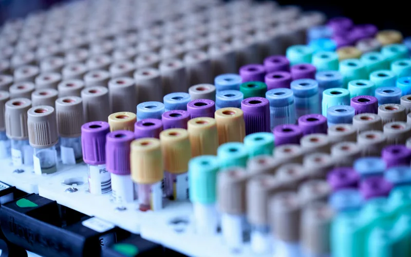 Rows of laboratory sample tubes in a rack